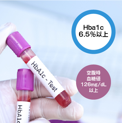 糖尿病(２型糖尿病)イメージ写真